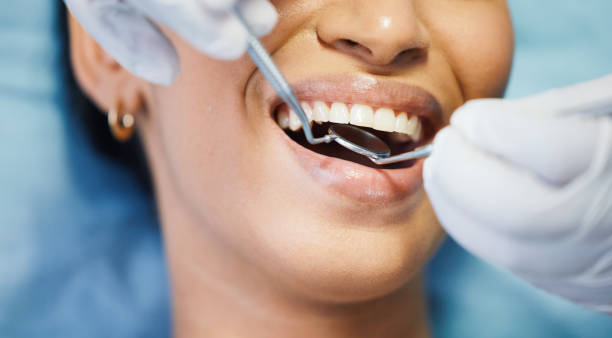 Best Emergency Dental Care for Broken or Chipped Teeth in Biggs, CA